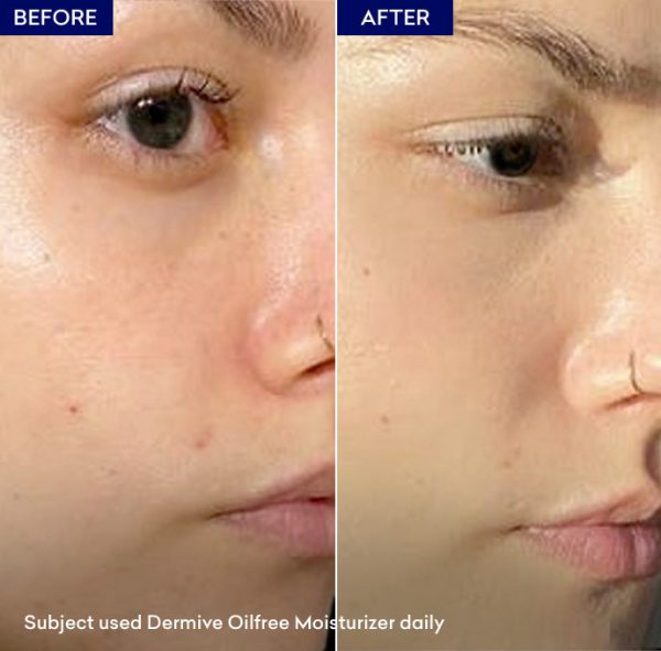 Dermi Ve Oil Free Moisturizer | Best Moisturizer For Skin Care | Best Quality Skin Moisturizer
